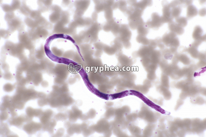 Microfilaire x200 - gryphea.org